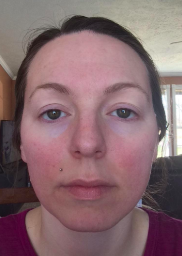 The reviewer's photo showing flushed red cheeks.
