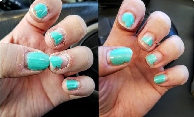 A before-and-after image showing a reviewer’s hands: one set dry and cracked, the other moisturized and smooth