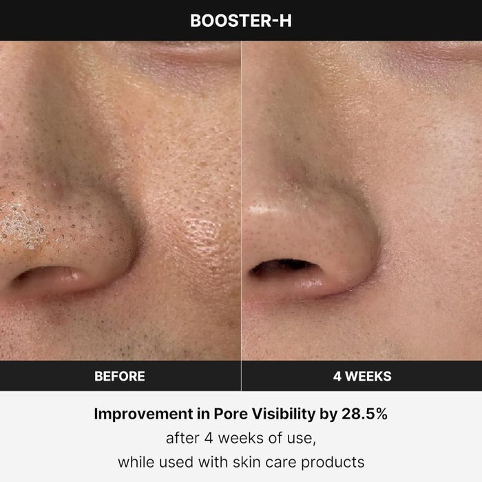 Two close-up photos of a person’s nose displayed side by side