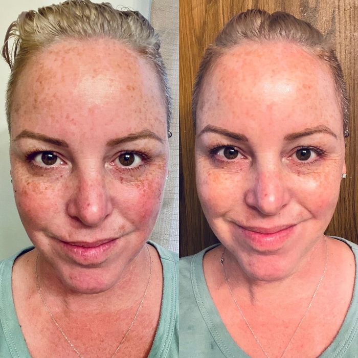 A reviewer's before and after photo showing significantly smoother, lifted, and brighter skin after using the mask