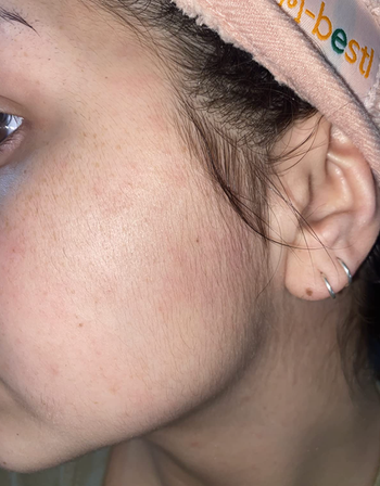 Before photo of a reviewer's face