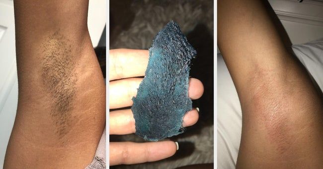 A reviewer's before image showing underarm hair, followed by a photo of the blue wax with hair, and an after image of smooth, hair-free underarms.