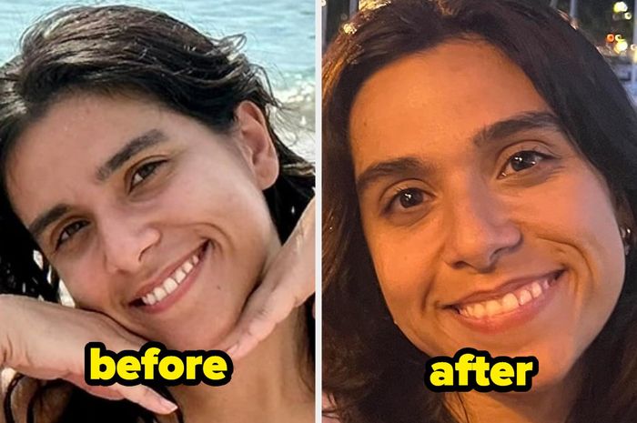Before-and-after photo of a reviewer showing dark under-eye circles significantly brightened after using the stick
