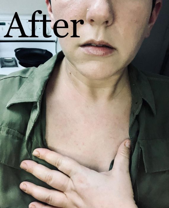 Reviewer's 'After' photo showing results from using the cream