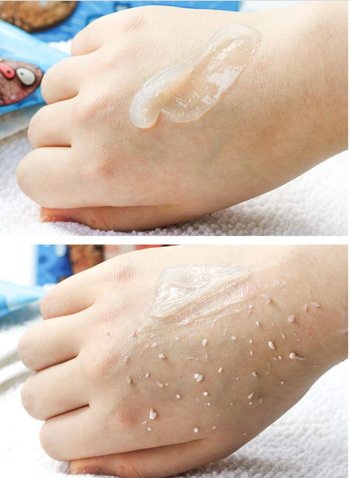 A side-by-side image of a hand with the peeling gel applied, demonstrating the removal of dry skin.