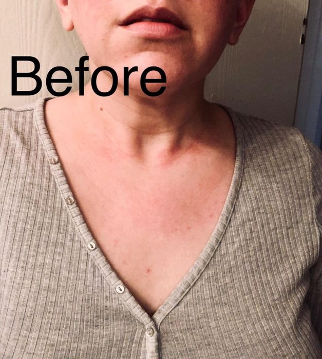 Reviewer's 'Before' photo