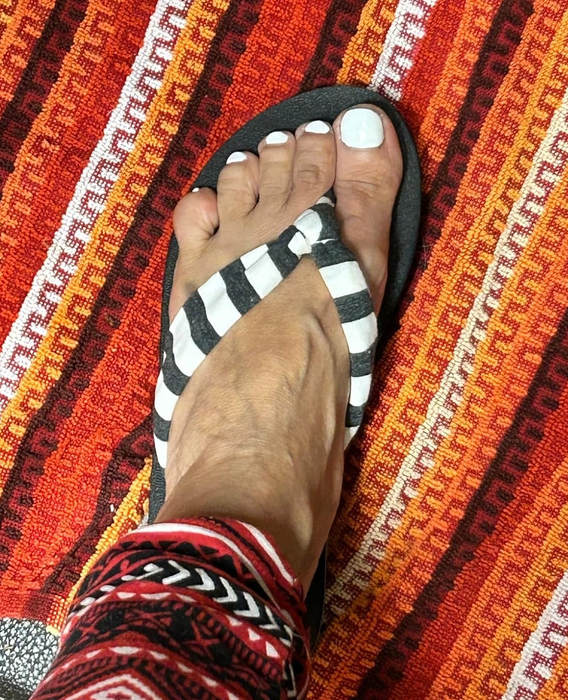 A person's foot in striped flip-flops