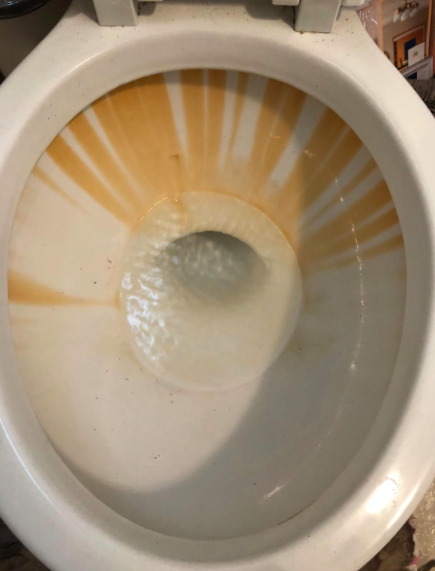 On the left, a toilet with yellow rings visible before using a pumice stone.