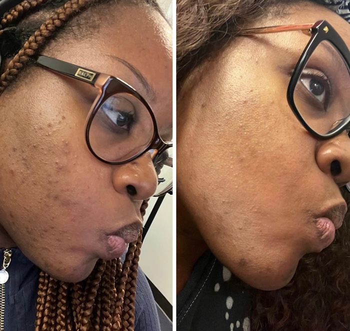 Side-by-side photos show a woman with glasses, with before (left) and after (right) skincare results showcasing an improved complexion.