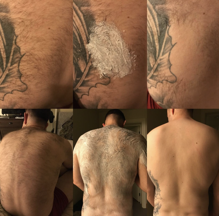 before and after of someone's back covered in hair, completely hair-free after use