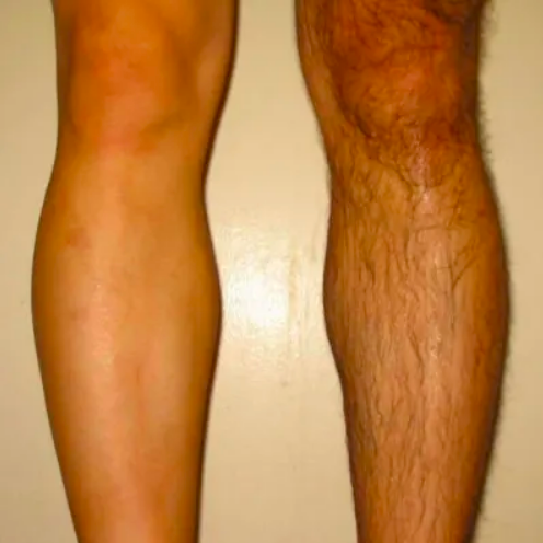 A reviewer with one leg still covered in hair and the other perfectly shaved
