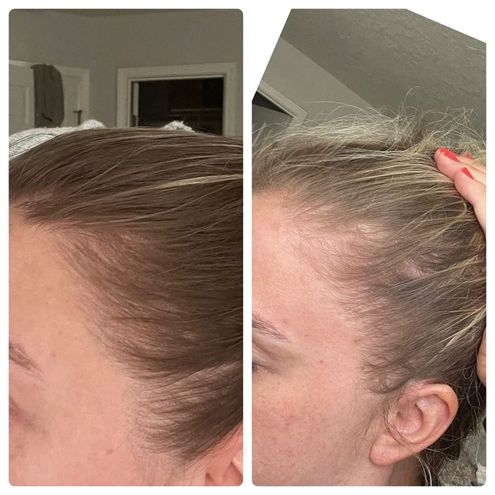 Two side-by-side before and after images of another reviewer's edges growing back
