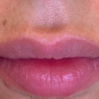 The same reviewer showing the hair removed after using the tool