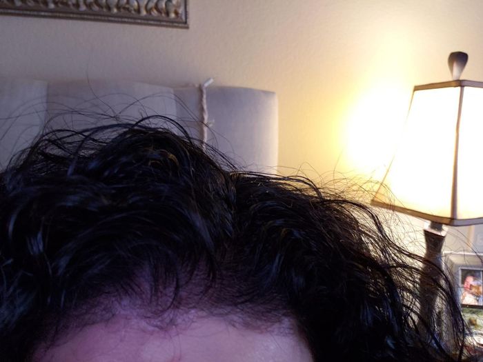 the same reviewer now showcasing fuller, thicker hair