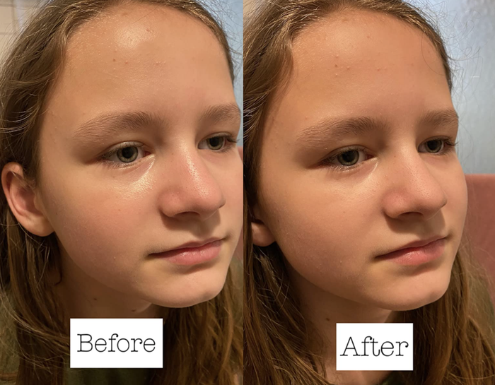 before and after results of using the oil-absorbing roller