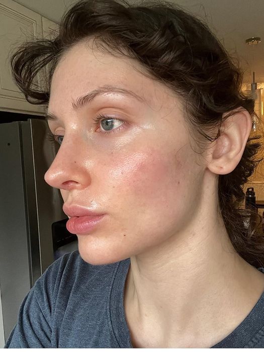 A reviewer applying the sunscreen, showing off their dewy skin.