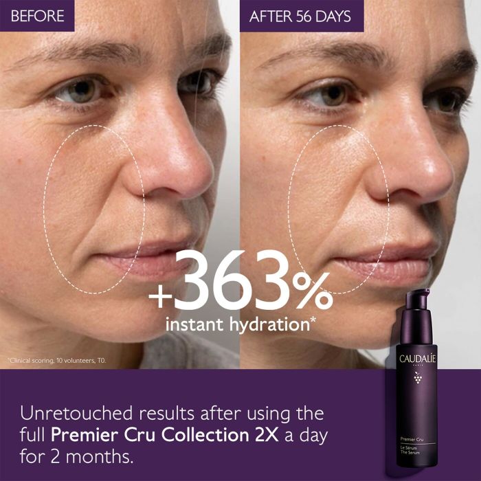 Before and after images of a model using the serum, showcasing the visible improvements in their skin's texture and radiance.