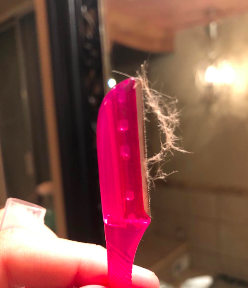 A customer review photo showing the razor with hair collected from the skin.