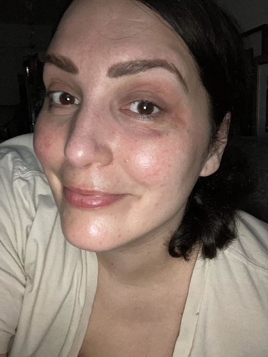 A reviewer's eyes before applying the eye cream.