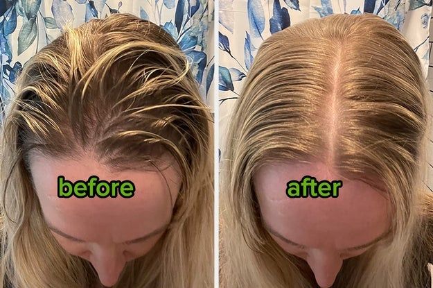 A reviewer’s hair before using the dry shampoo powder, showing extremely oily blonde hair, and after applying it, the hair appears much fresher and less greasy