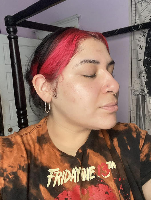 same reviewer after applying the serum, now with visibly clearer skin