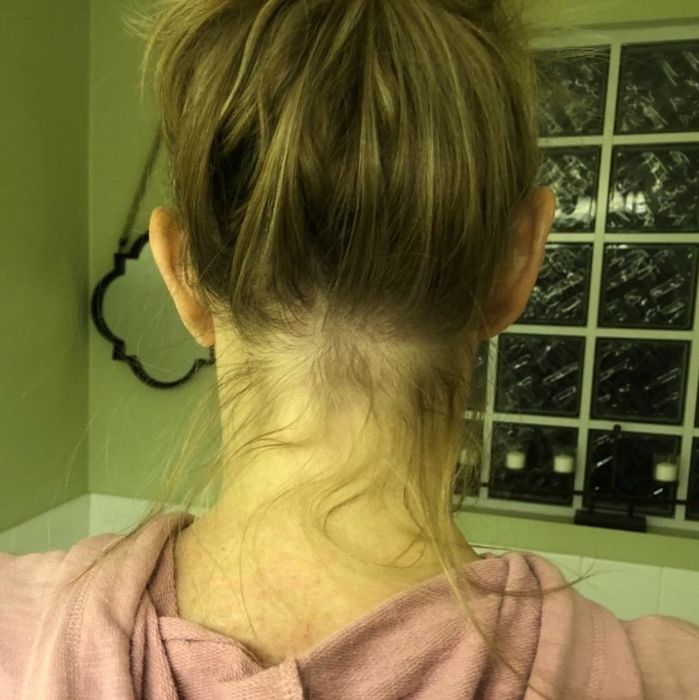 A reviewer showing their messy bun with flyaways at the back