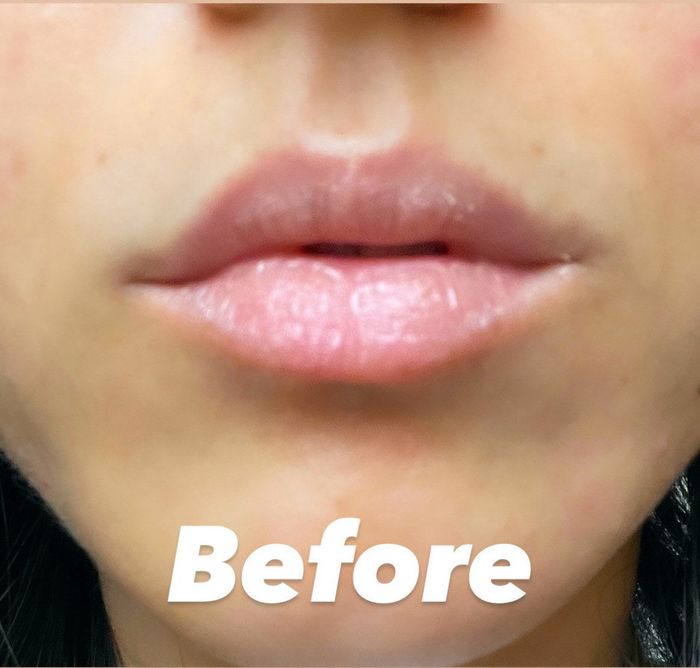 Jasmin showing her chapped lips before applying the mask