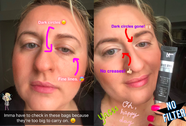 On the left, Mytour writer's face shows her dark under-eye circles and fine lines, while on the right, the same writer is wearing the concealer with no circles or lines visible.