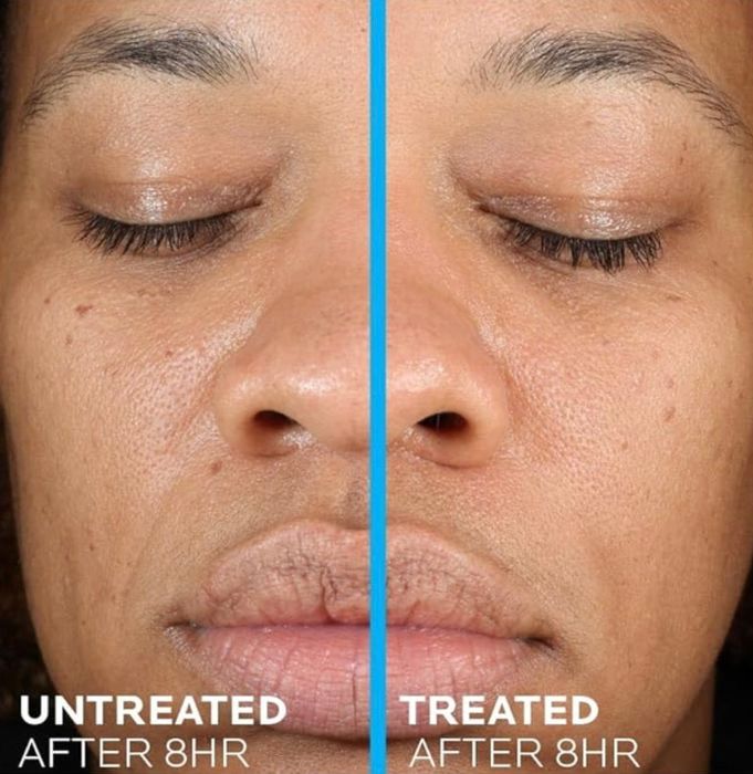 A close-up of a person's face showing a skincare treatment comparison, with the left side labeled.