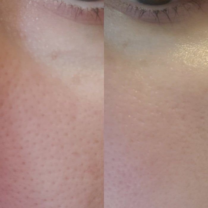 A reviewer demonstrating how their pores are blurred after using the primer