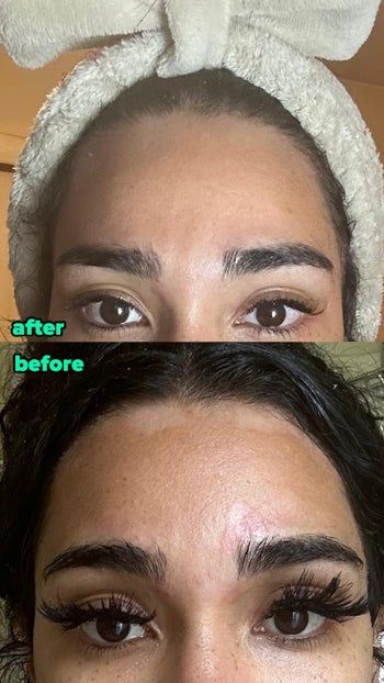 Two close-up images showing a reviewer's forehead and eyebrows, highlighting changes in hair growth or cosmetic adjustments. No text included.