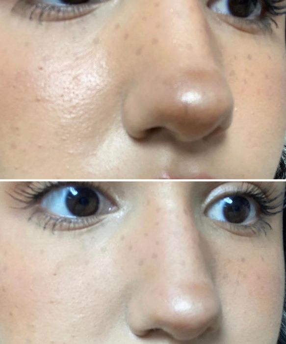 A reviewer demonstrates their oily T-zone before using the roller and the more matte result after applying it.