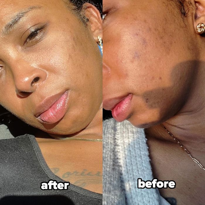 A split image with close-up shots of a woman's face, labeled.