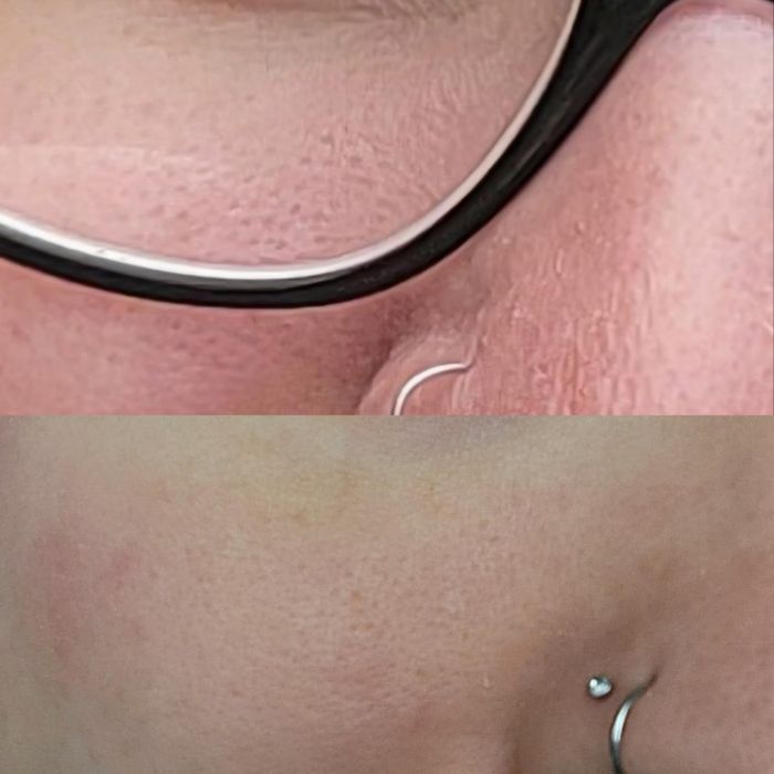 Close-up images of skin with and without glasses highlighting the details of a nose piercing and skin texture
