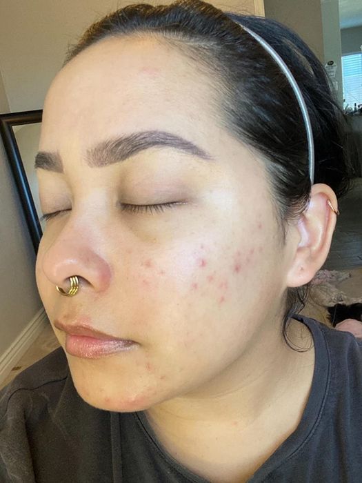 Reviewer before applying the foundation, showing a few blemishes.
