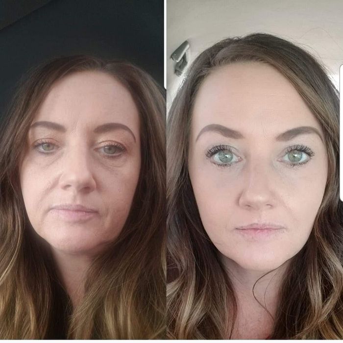Before/after comparison of a reviewer's face after using the serum.