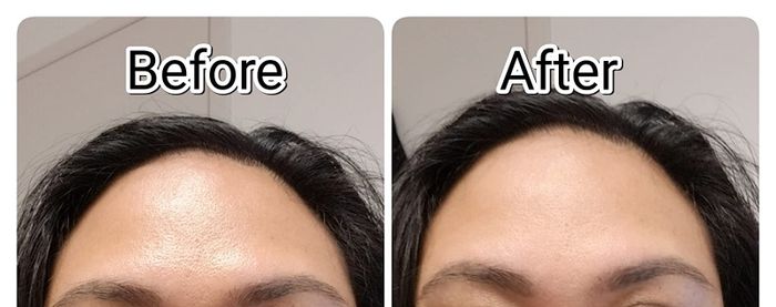 before and after images showing a reviewer's oily forehead transformed to dry, matte skin
