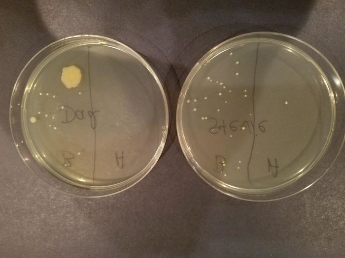 A reviewer showing petri dishes before and after sanitizing a phone (with significantly fewer germ colonies after cleaning)