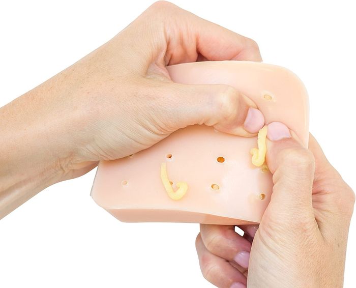 a model squeezing the imitation pimple