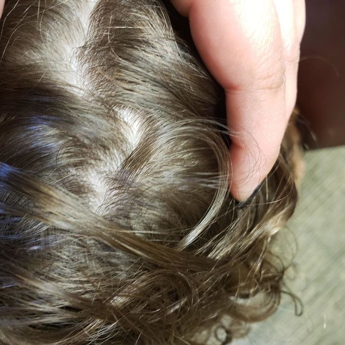 A reviewer's photo of a clean, flake-free scalp after using the shampoo