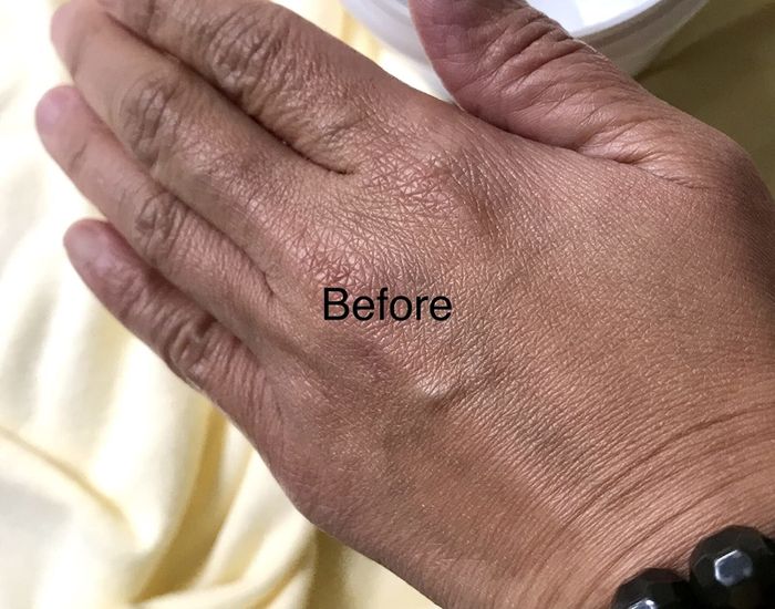 A reviewer's photo of dry hands before applying the cream
