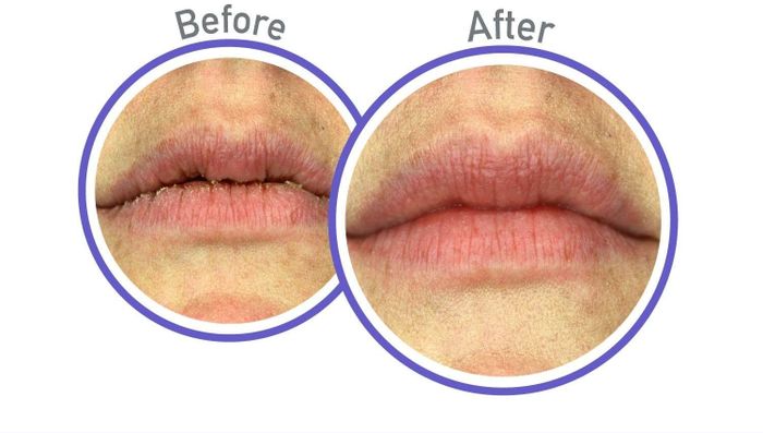 Before-and-after photos showing chapped lips transformed into smooth, hydrated lips after applying the treatment