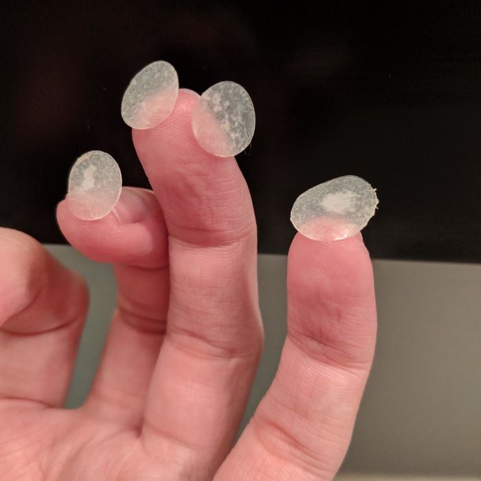 A reviewer's photo of used pimple patches after application