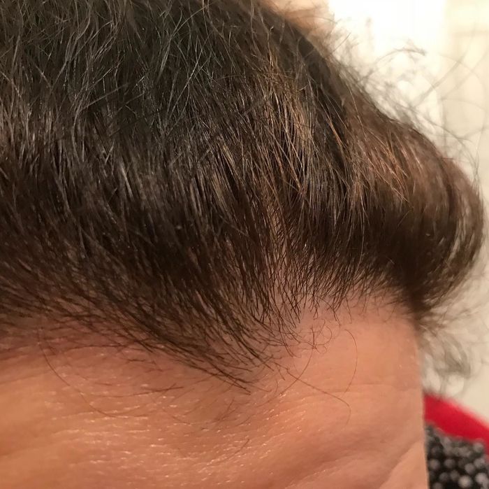 The same reviewer with a scalp that no longer looks flaky