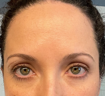 The same reviewer who used the makeup primer, now showing a matte forehead.
