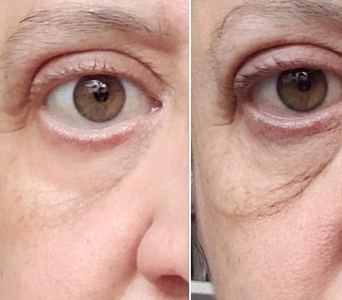 Before and after images of the reviewer showing the eye cream's effect on tightening and brightening their under-eye area.