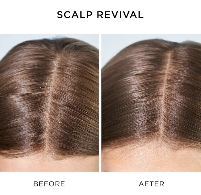 A model displays the before-and-after effects of using Briogeo Scalp Revival.