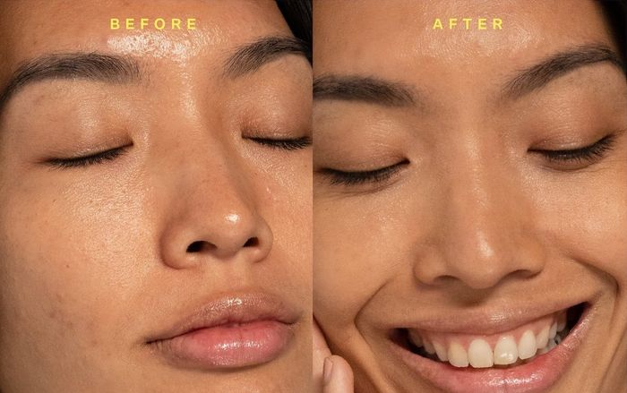 before and after images of a model displaying their face with and without the product applied