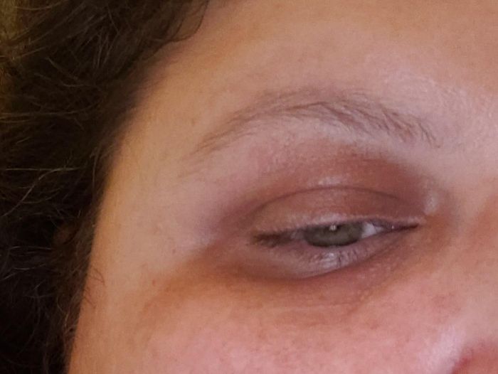 A reviewer showing their dark circles around the eyes