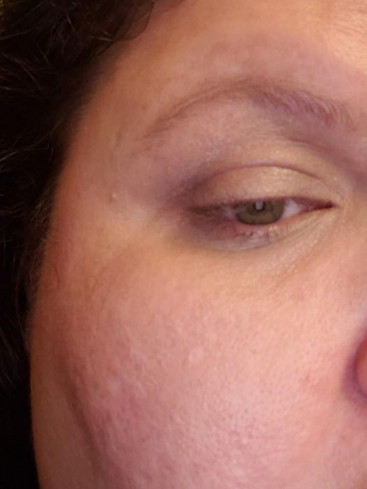 The same reviewer after applying the concealer, now with no visible dark circles